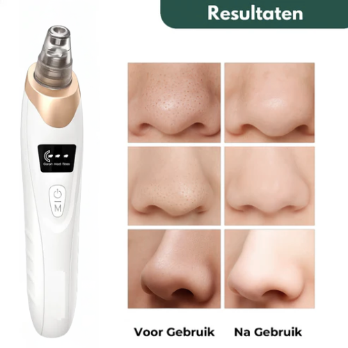 LumiPore™ I Voor een huid die straalt